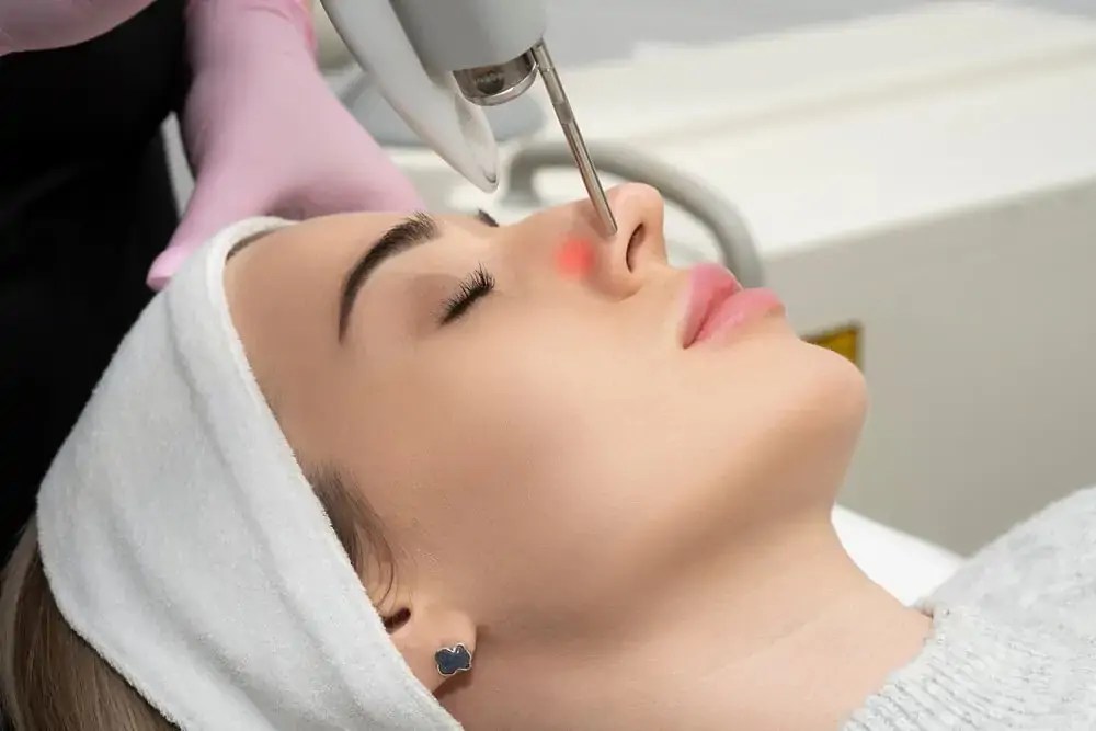 Brightening & Melasma Laser treatment