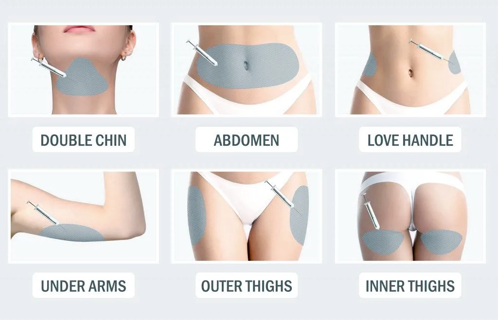 Common areas treated with fat melting injections: double chin, abdomen, love handles, under arms, outer thighs and inner thighs
