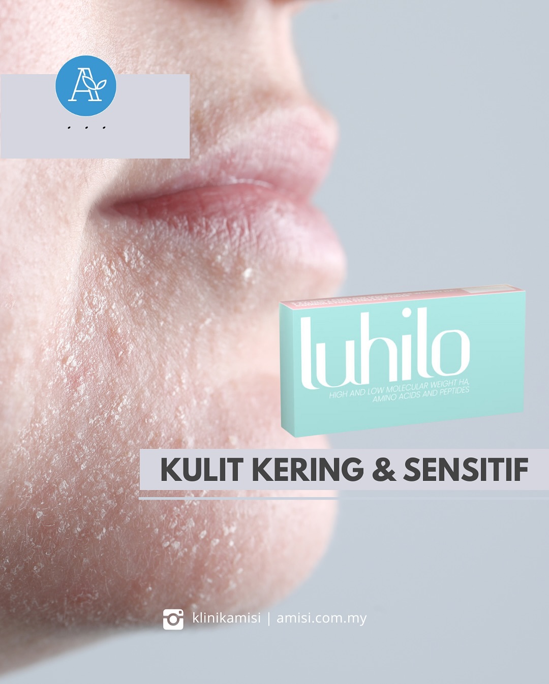 Luhilo treatment