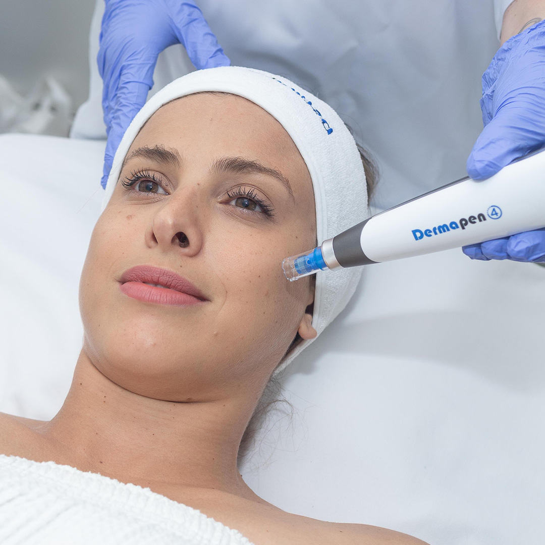 Microneedling & Dermapen treatment