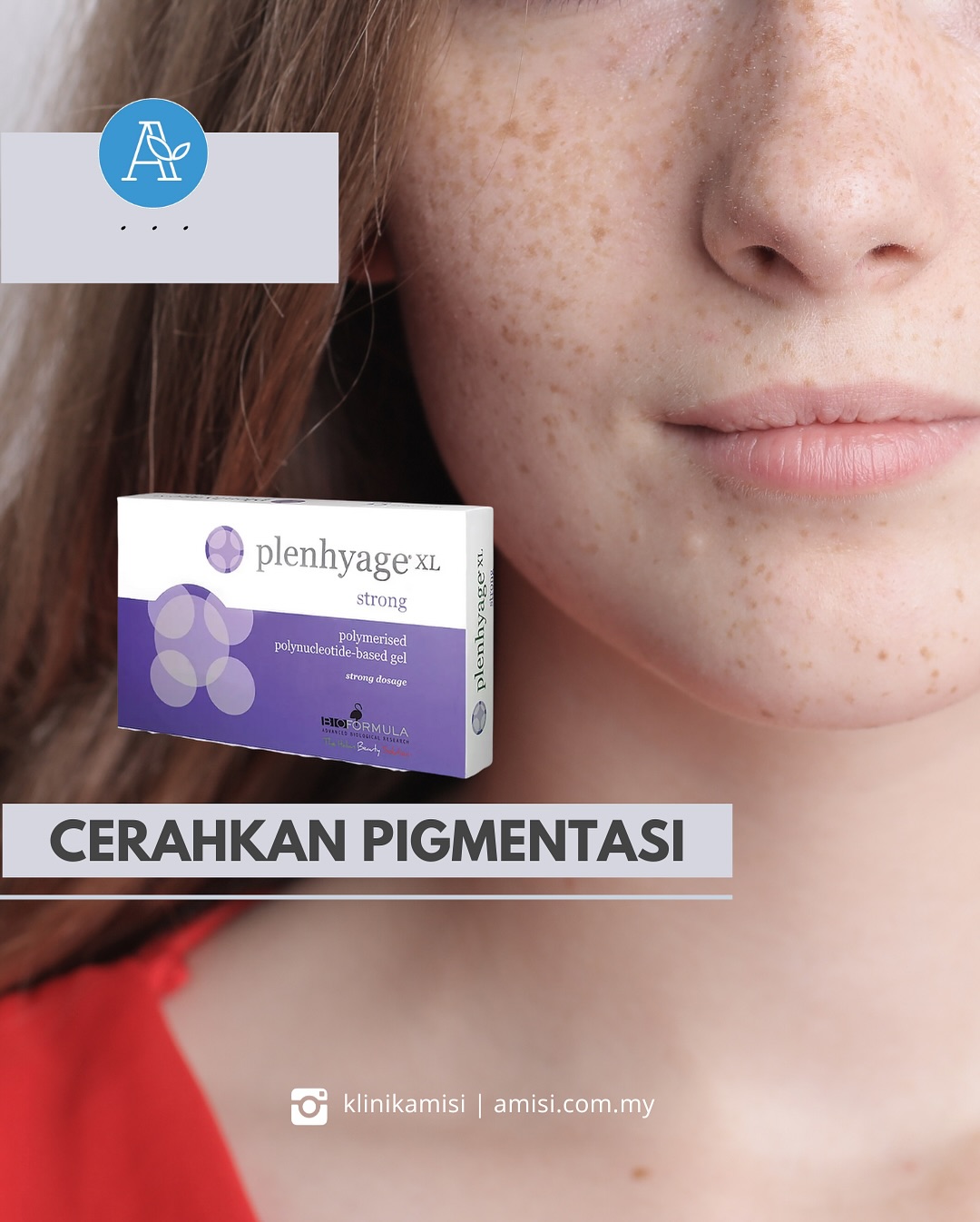 Plenhyage treatment
